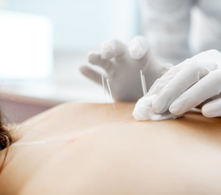 All Care Acupuncture